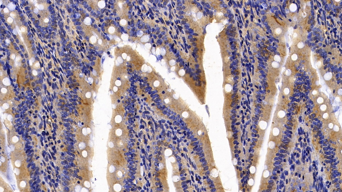 Monoclonal Antibody to Calreticulin (CALR)