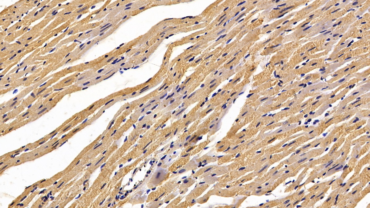 Monoclonal Antibody to Calreticulin (CALR)