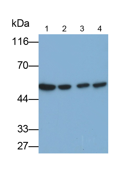 Monoclonal Antibody to Calreticulin (CALR)