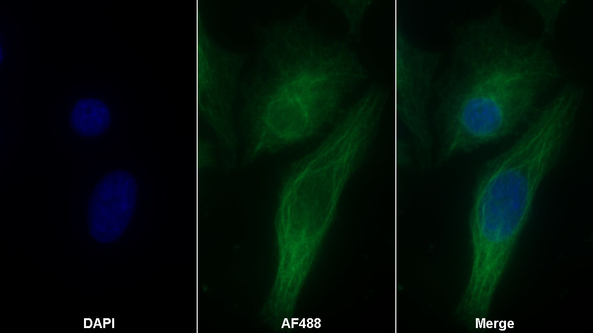 Monoclonal Antibody to Calreticulin (CALR)