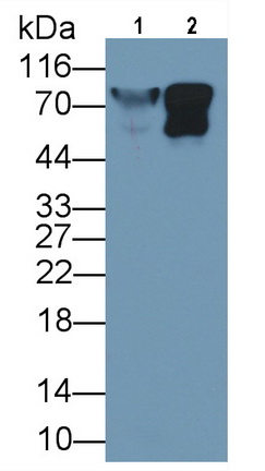 Monoclonal Antibody to Lumican (LUM)