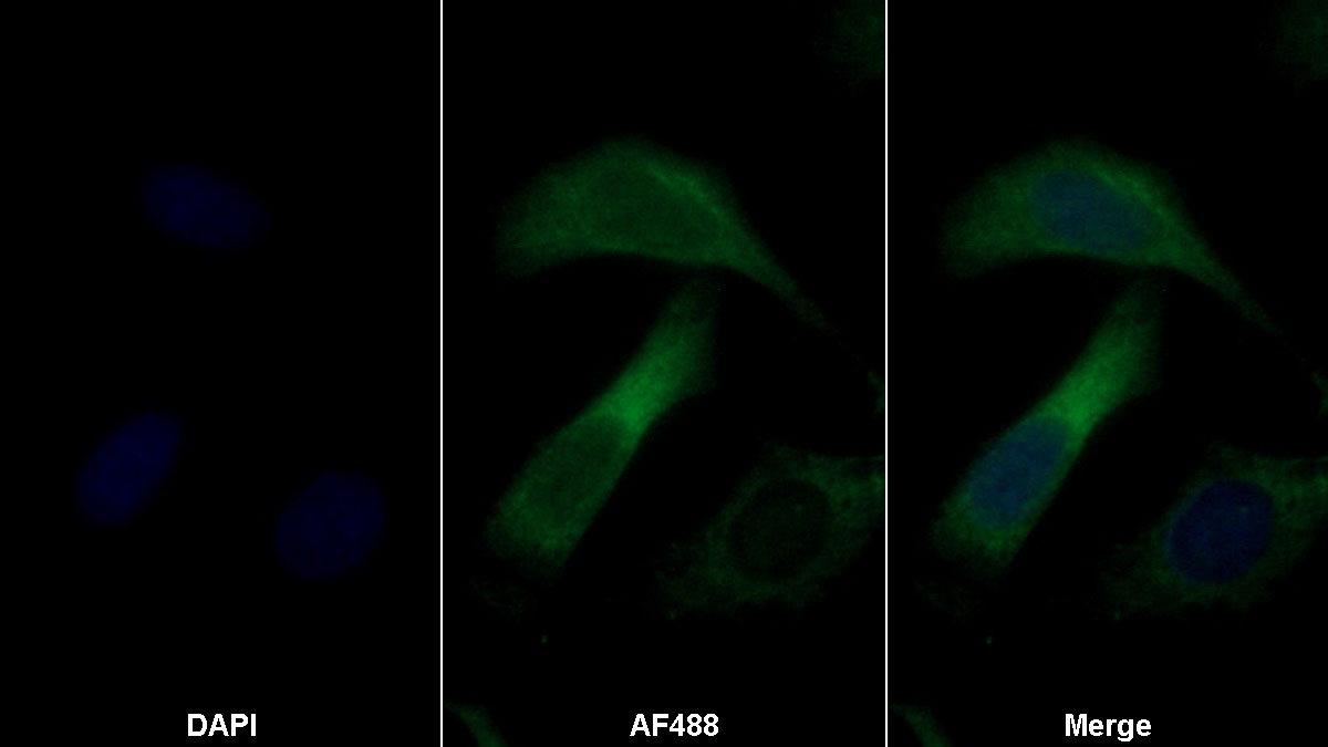 Monoclonal Antibody to Lumican (LUM)