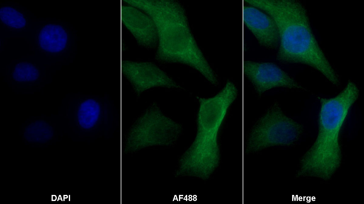 Monoclonal Antibody to Lumican (LUM)