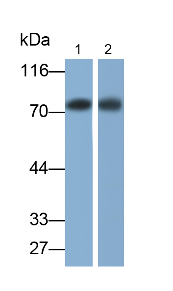 Monoclonal Antibody to Interleukin 5 Receptor Alpha (IL5Ra)