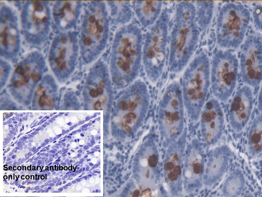 Monoclonal Antibody to Lipopolysaccharide (LPS)