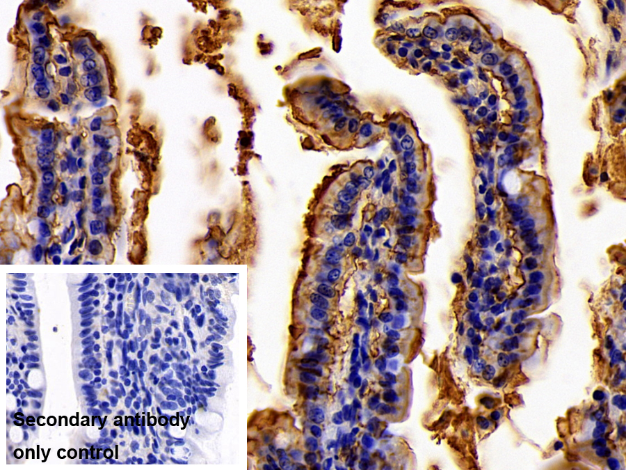 Monoclonal Antibody to Lipopolysaccharide (LPS)