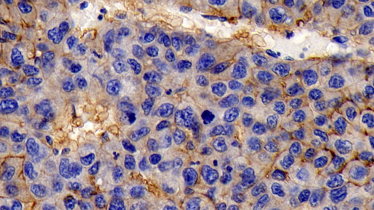 Monoclonal Antibody to Cluster Of Differentiation 147 (CD147)