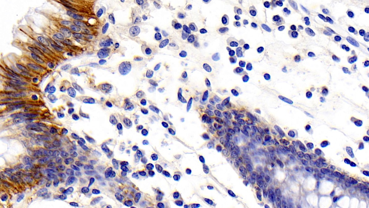 Monoclonal Antibody to Cluster Of Differentiation 147 (CD147)