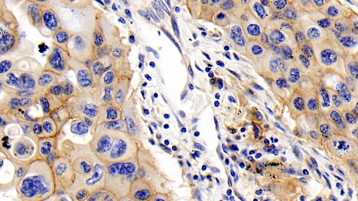 Monoclonal Antibody to Cluster Of Differentiation 147 (CD147)