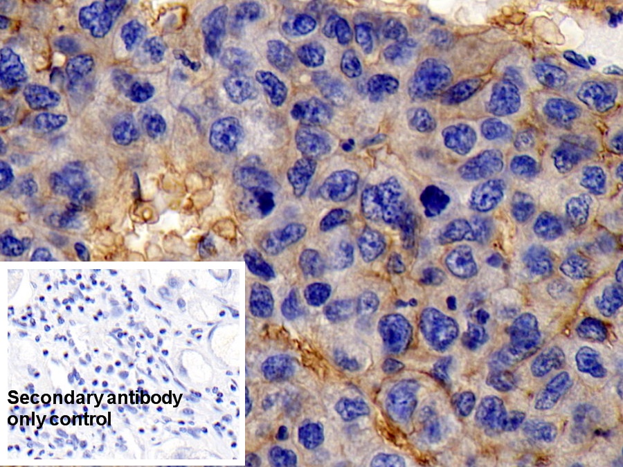 Monoclonal Antibody to Cluster Of Differentiation 147 (CD147)