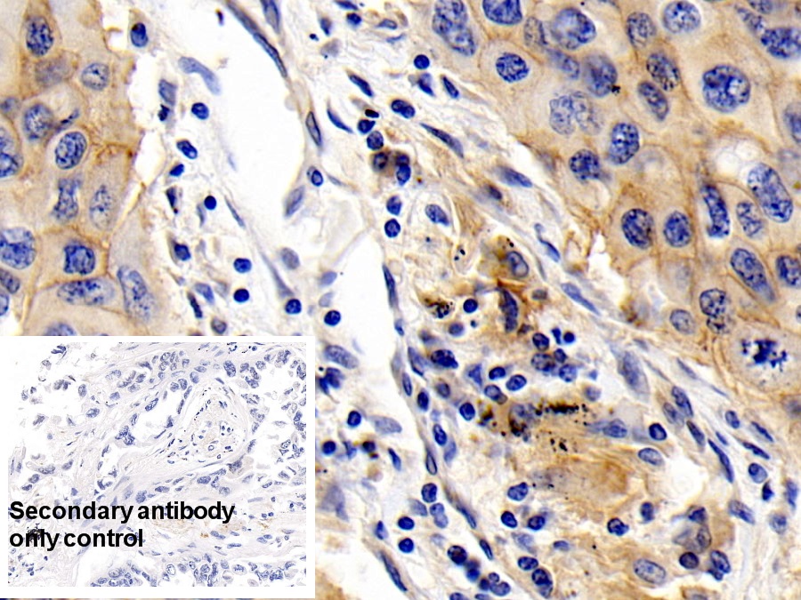 Monoclonal Antibody to Cluster Of Differentiation 147 (CD147)