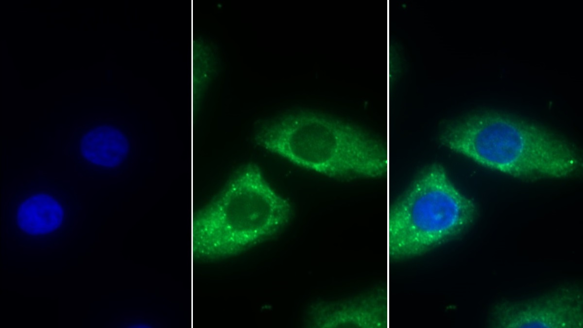 Monoclonal Antibody to Cluster Of Differentiation 147 (CD147)