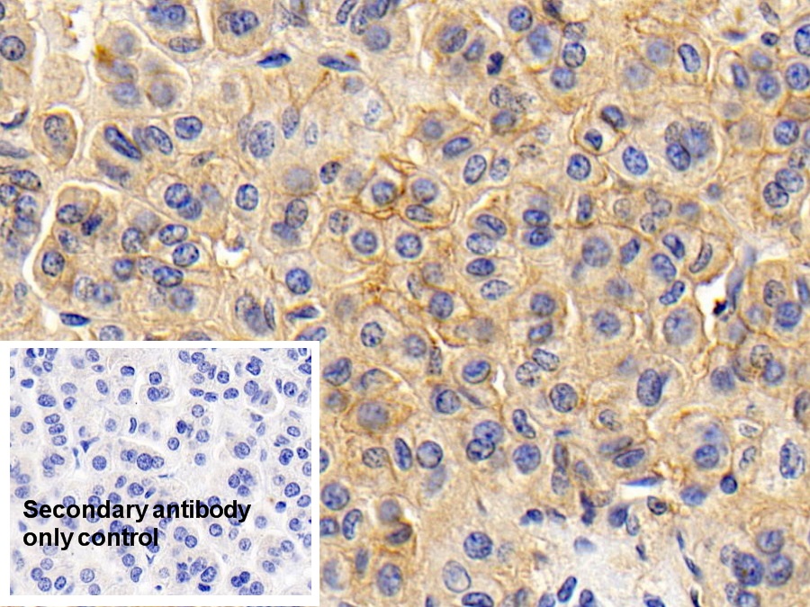 Monoclonal Antibody to Cluster Of Differentiation 147 (CD147)