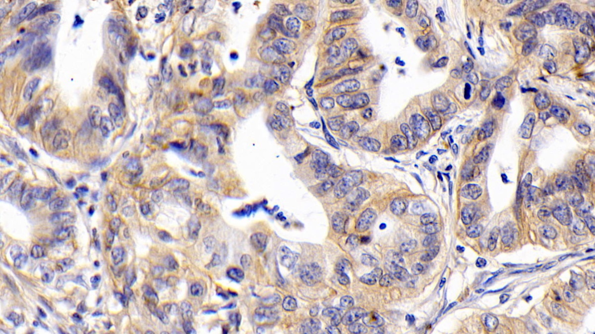 Monoclonal Antibody to Cluster Of Differentiation 147 (CD147)