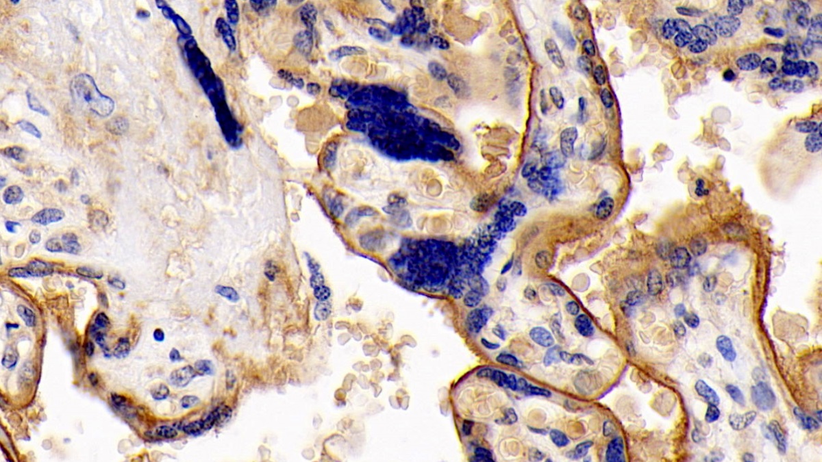 Monoclonal Antibody to Cluster Of Differentiation 147 (CD147)