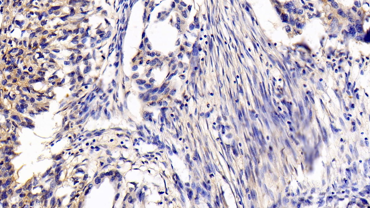 Monoclonal Antibody to Cluster Of Differentiation 147 (CD147)