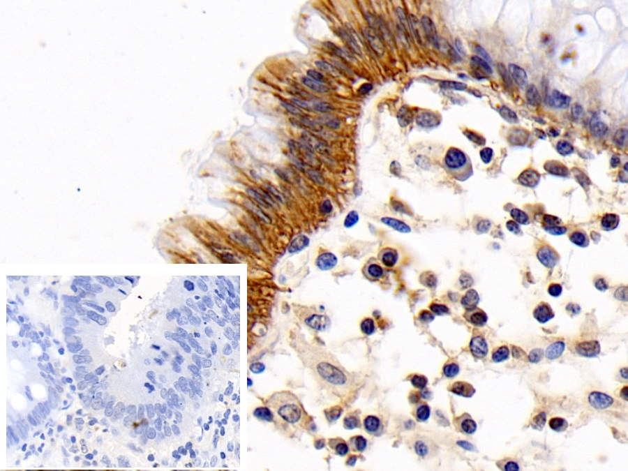 Monoclonal Antibody to Cluster Of Differentiation 147 (CD147)