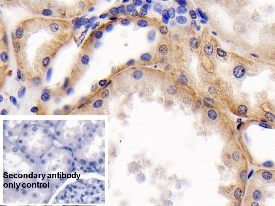 Monoclonal Antibody to Cluster Of Differentiation 147 (CD147)