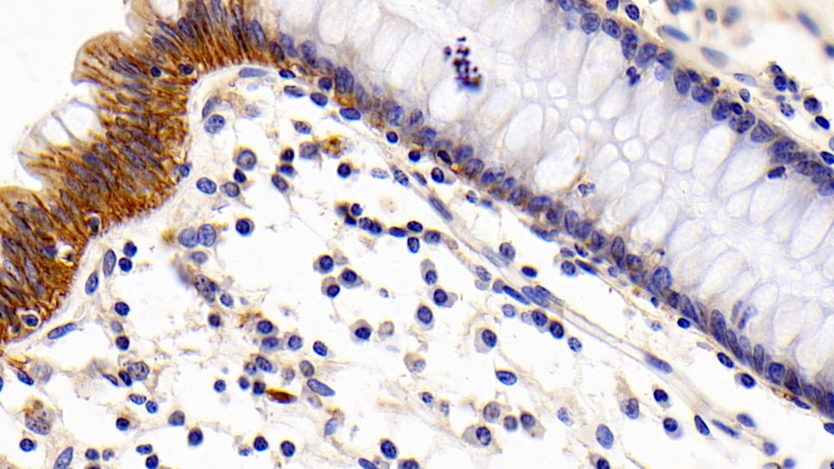 Monoclonal Antibody to Cluster Of Differentiation 147 (CD147)