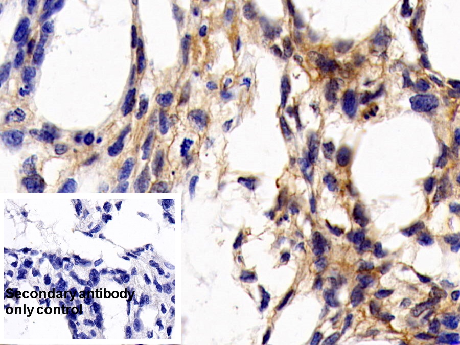 Monoclonal Antibody to Cluster Of Differentiation 147 (CD147)