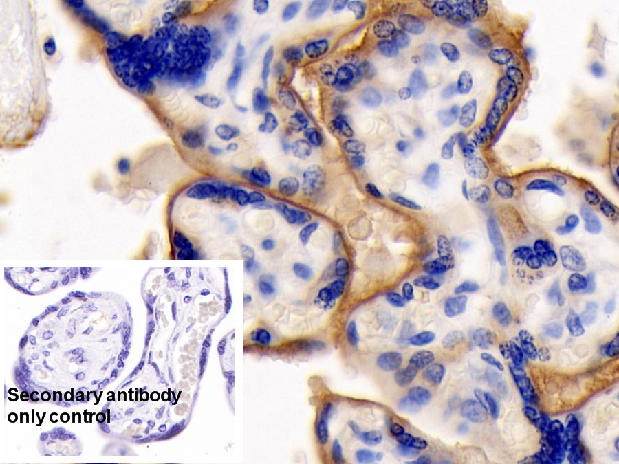 Monoclonal Antibody to Cluster Of Differentiation 147 (CD147)