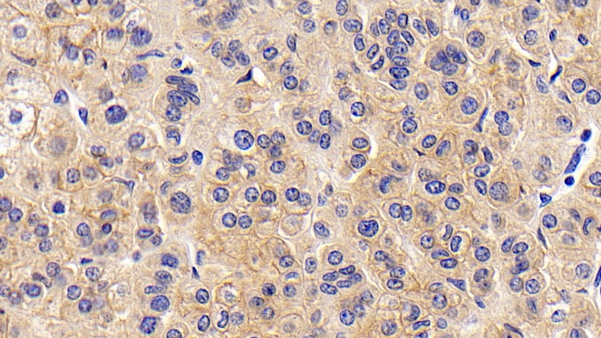 Monoclonal Antibody to Cluster Of Differentiation 147 (CD147)