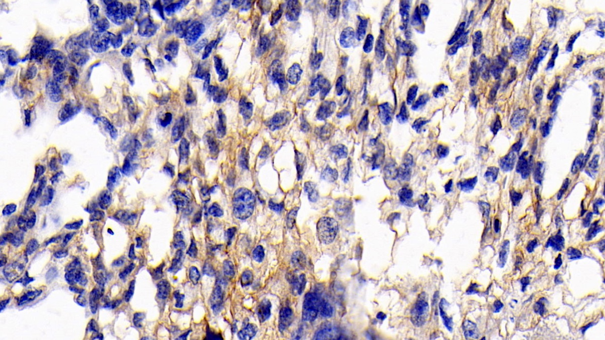 Monoclonal Antibody to Cluster Of Differentiation 147 (CD147)