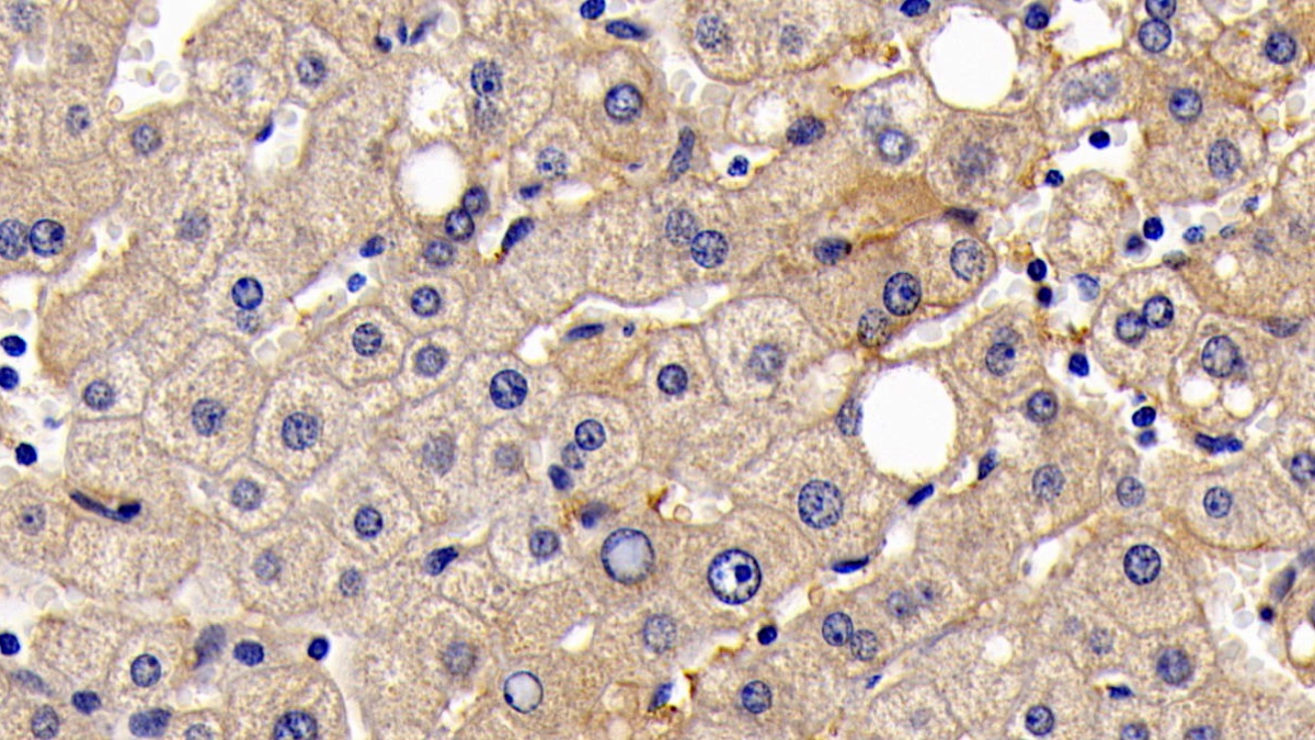 Monoclonal Antibody to Cluster Of Differentiation 147 (CD147)