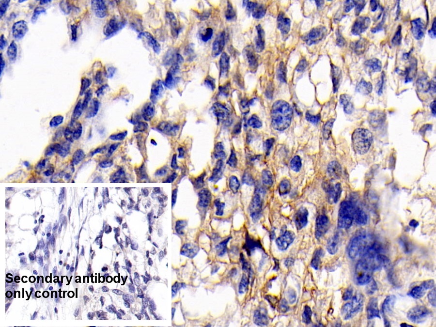 Monoclonal Antibody to Cluster Of Differentiation 147 (CD147)