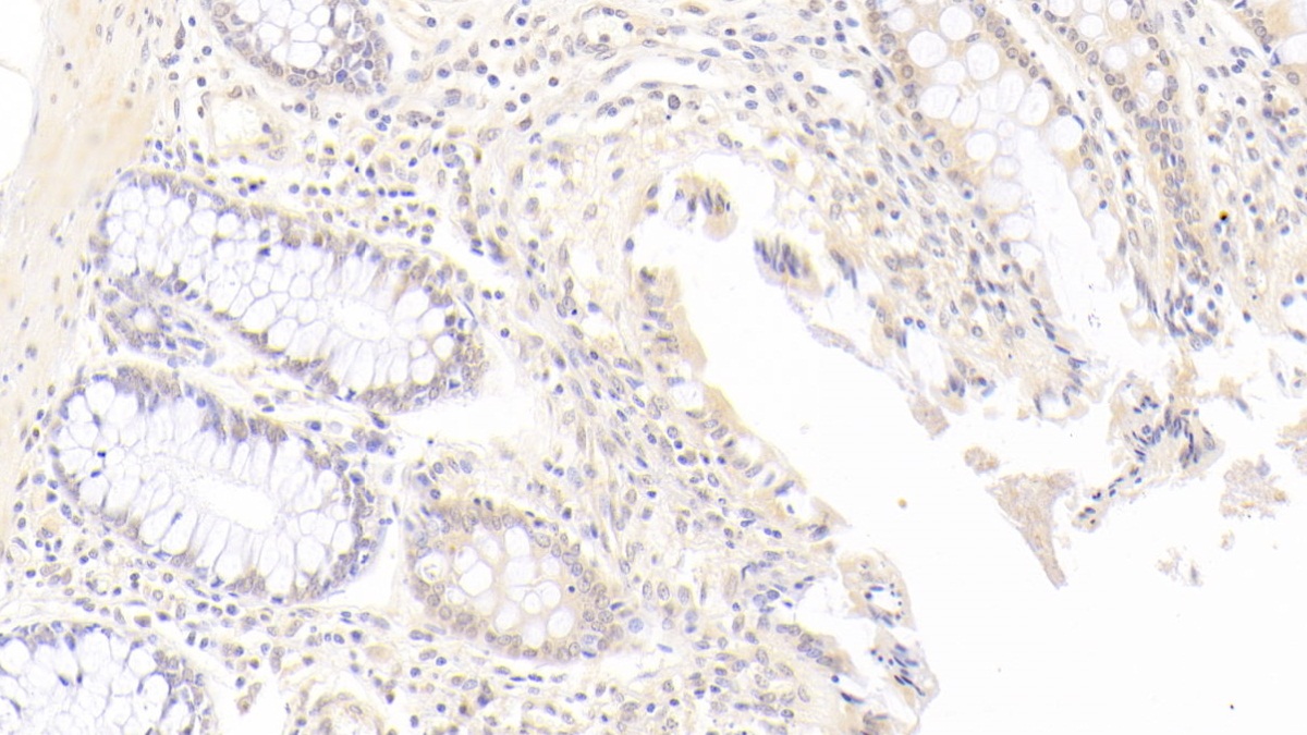 Monoclonal Antibody to Indoleamine-2,3-Dioxygenase (IDO)