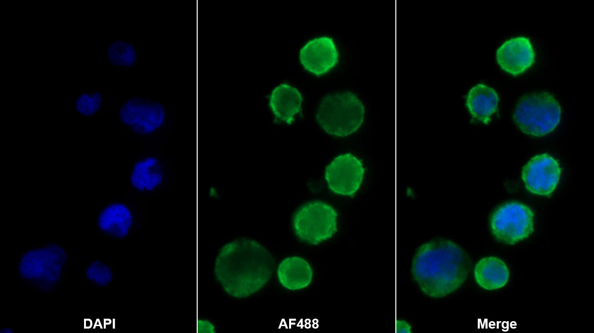 Monoclonal Antibody to Bone Marrow Stromal Cell Antigen 1 (BST1)