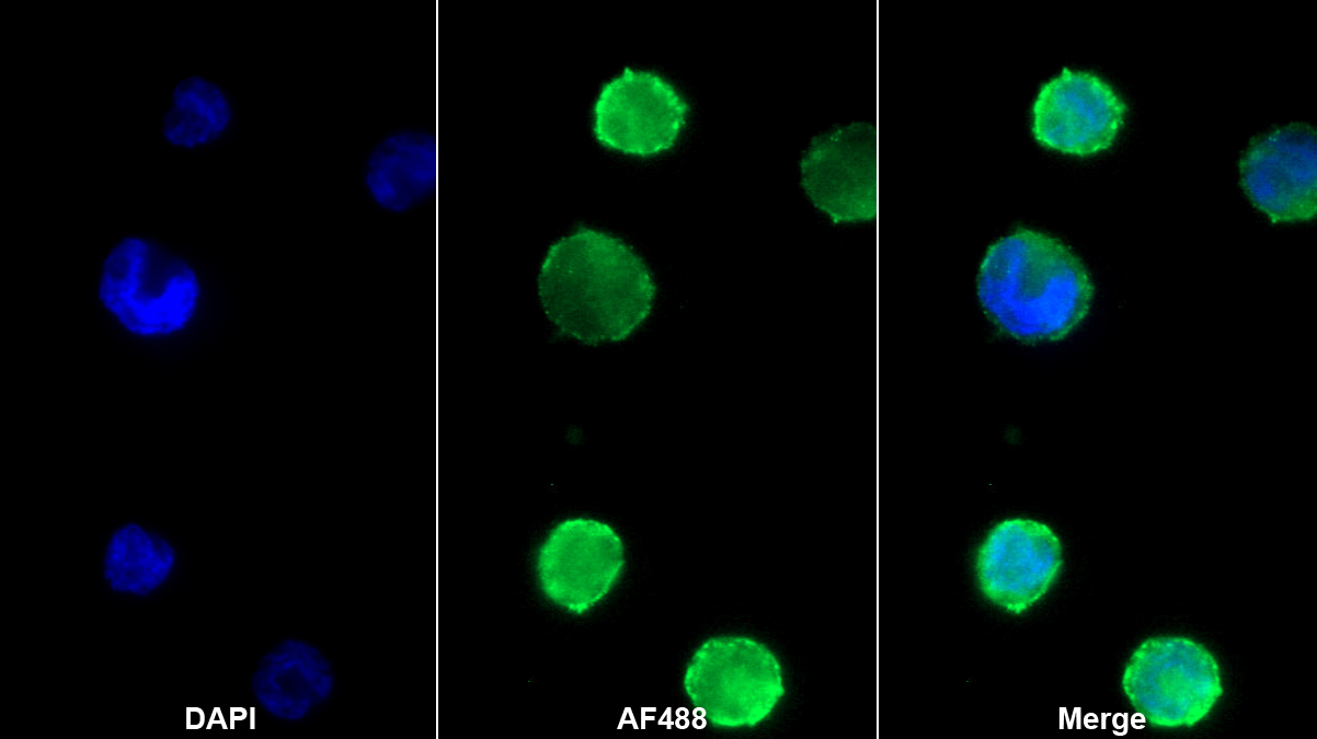 Monoclonal Antibody to Bone Marrow Stromal Cell Antigen 1 (BST1)