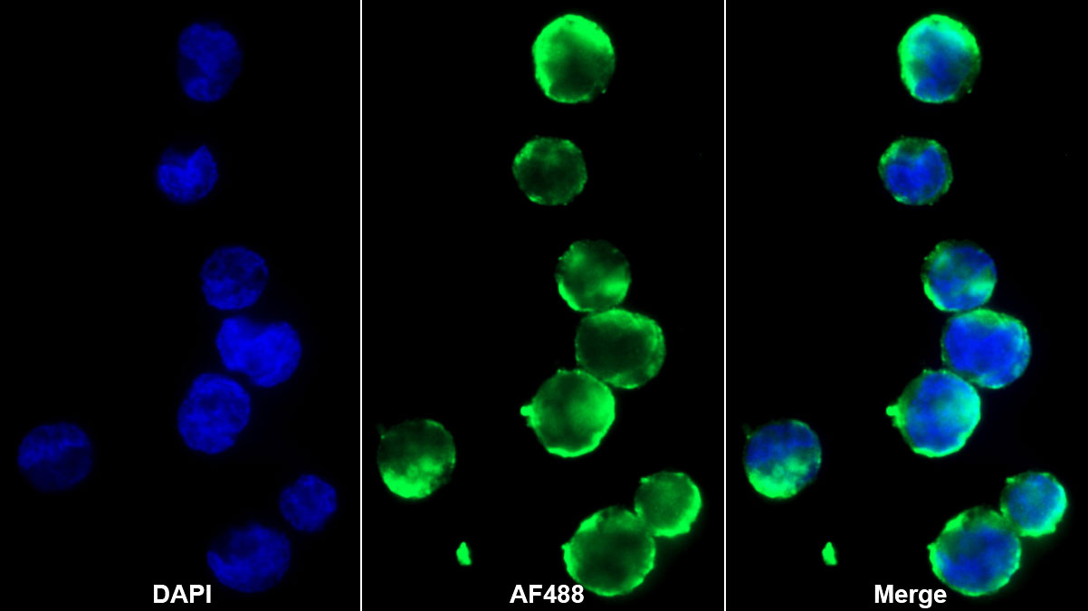 Monoclonal Antibody to Bone Marrow Stromal Cell Antigen 1 (BST1)