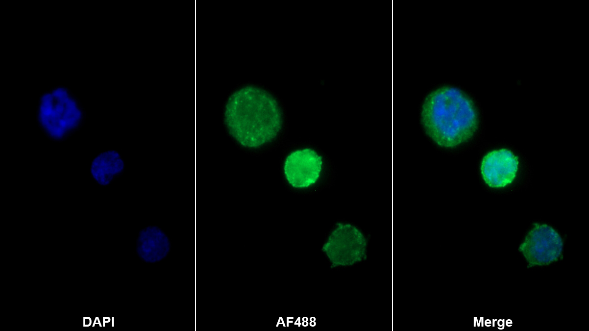 Monoclonal Antibody to Bone Marrow Stromal Cell Antigen 1 (BST1)