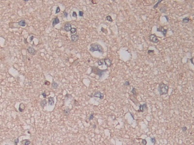 Monoclonal Antibody to A Disintegrin And Metalloprotease 17 (ADAM17)