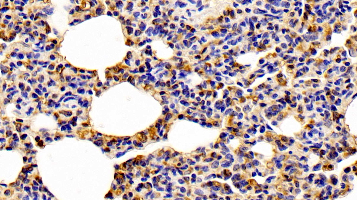 Monoclonal Antibody to Cofilin 1 (CFL1)