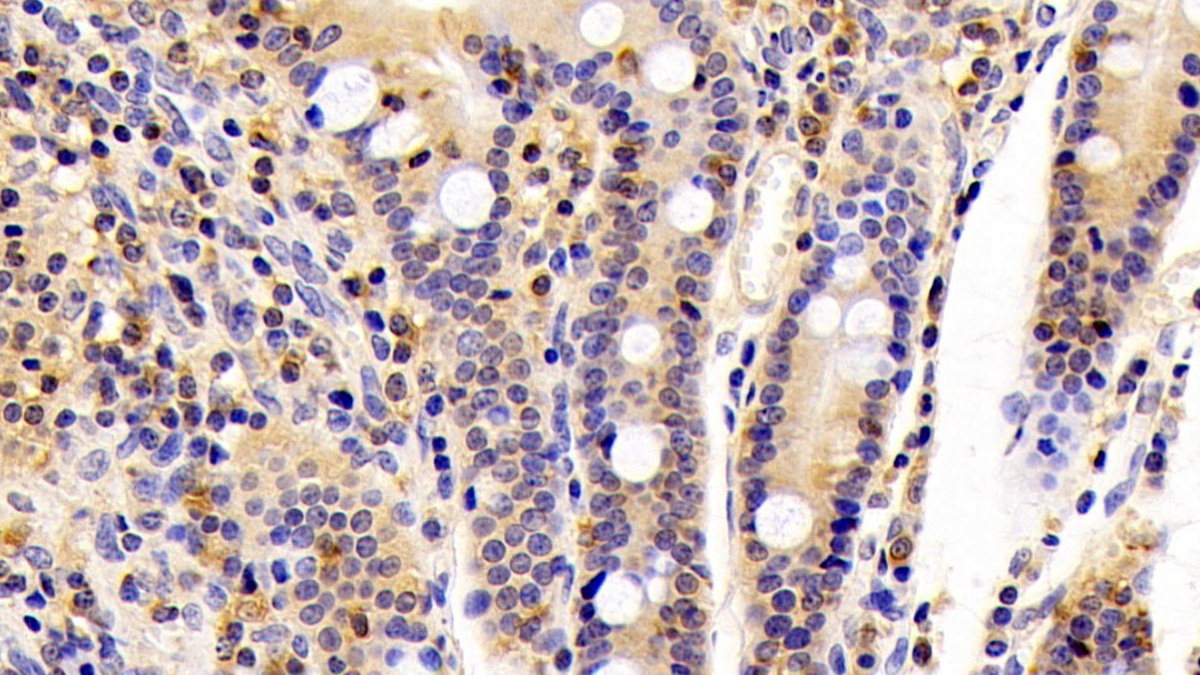 Monoclonal Antibody to Cofilin 1 (CFL1)