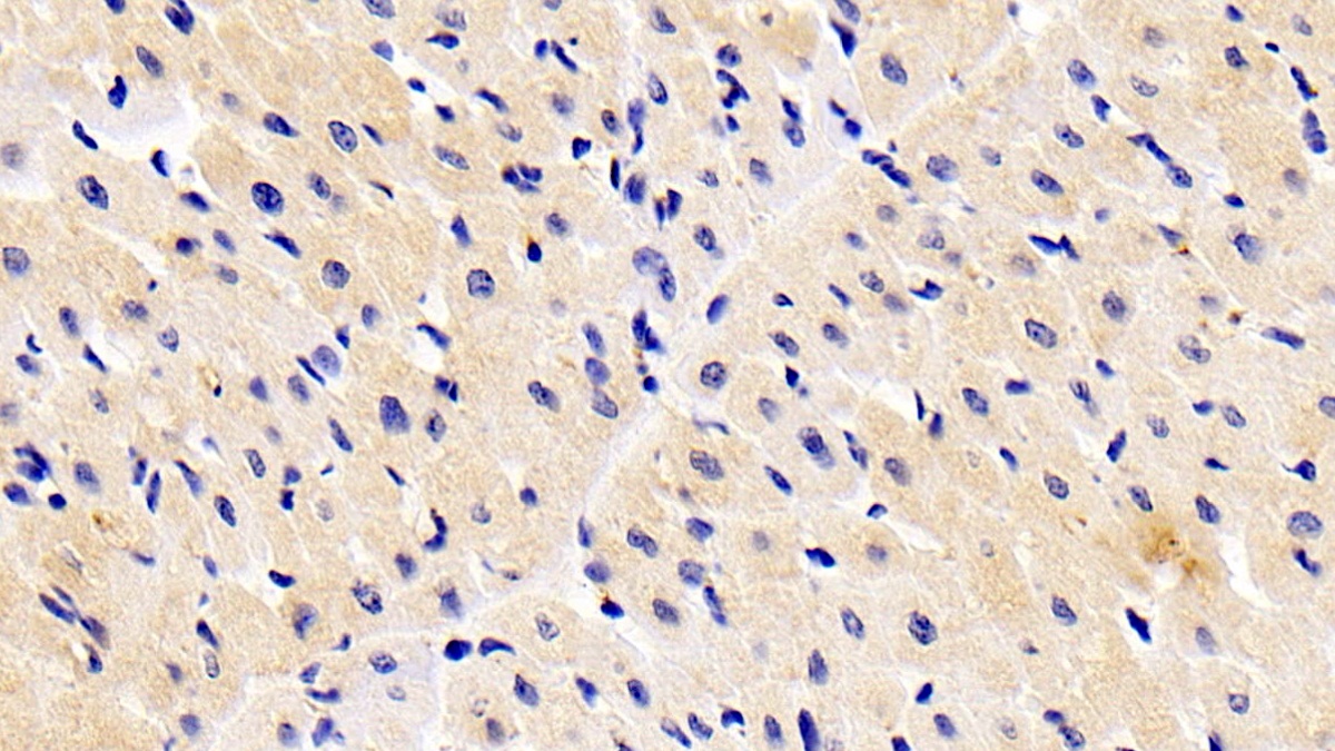 Monoclonal Antibody to Cofilin 1 (CFL1)