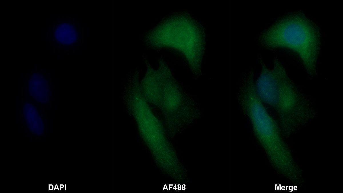 Monoclonal Antibody to Cofilin 1 (CFL1)