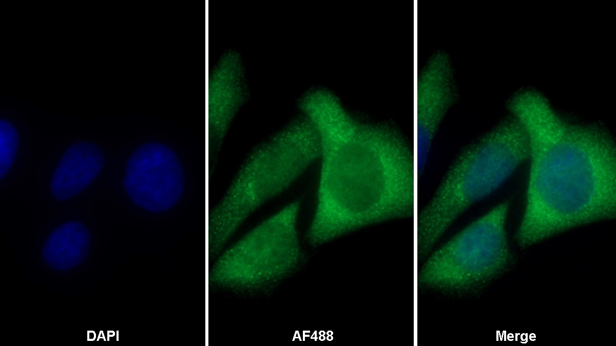 Monoclonal Antibody to Cofilin 1 (CFL1)