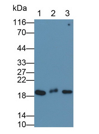 Monoclonal Antibody to Cofilin 1 (CFL1)