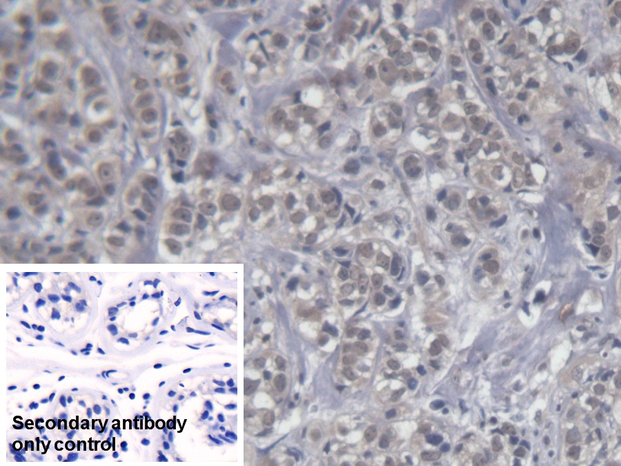 Monoclonal Antibody to Killer Cell Immunoglobulin Like Receptor 2DS4 (KIR2DS4)