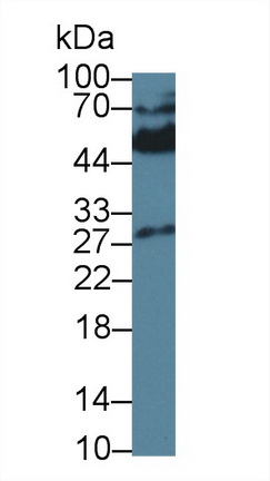 Monoclonal Antibody to Killer Cell Immunoglobulin Like Receptor 2DS4 (KIR2DS4)