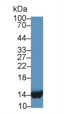 Monoclonal Antibody to Fatty Acid Binding Protein 1 (FABP1)