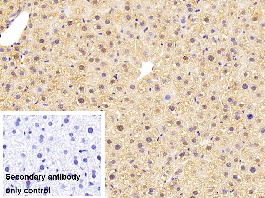 Monoclonal Antibody to Fatty Acid Binding Protein 1 (FABP1)