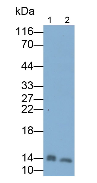 Monoclonal Antibody to Fatty Acid Binding Protein 1 (FABP1)