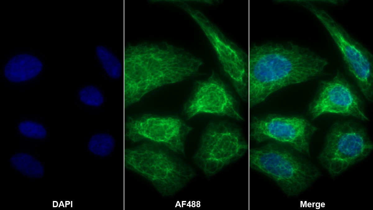 Monoclonal Antibody to Fatty Acid Binding Protein 1 (FABP1)