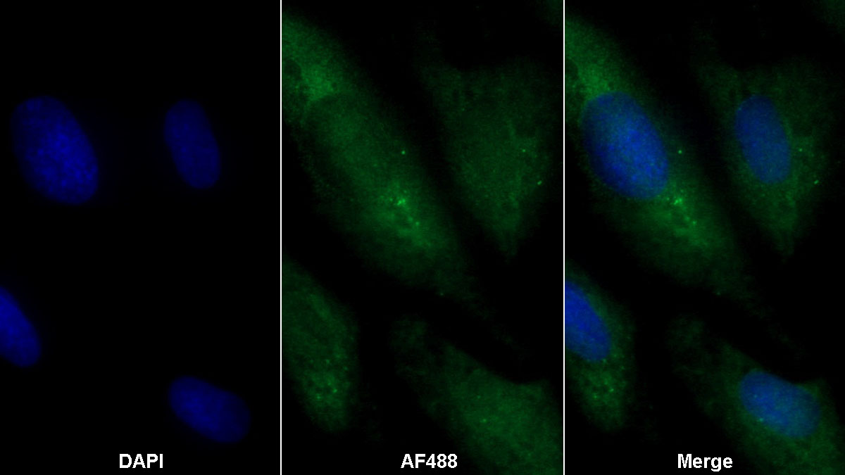 Monoclonal Antibody to Lymphocyte Antigen 75 (LY75)