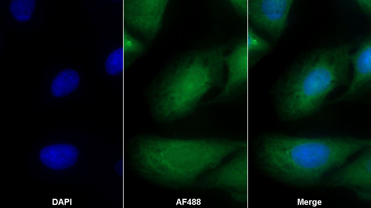 Monoclonal Antibody to Lymphocyte Antigen 75 (LY75)