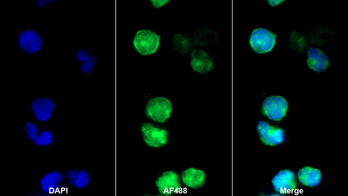 Monoclonal Antibody to Tyrosine Kinase 2 (Tyk2)